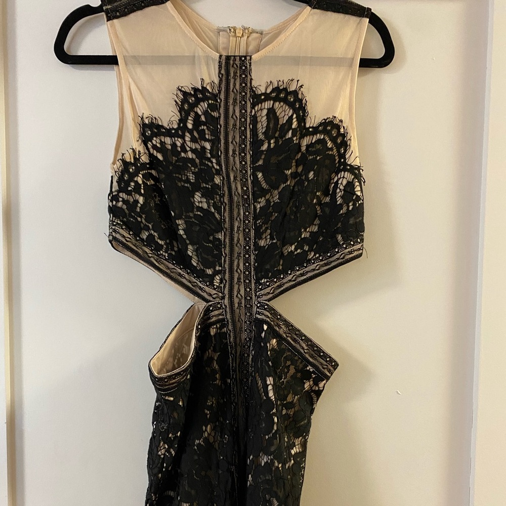 3 Tobi Dresses